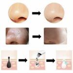 ASPIRATORE ASPIRA RIMUOVI PUNTI NERI 4 TESTINE VISO PULIZIA FACCIALE PORI - immagine 3