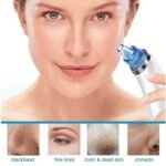 ASPIRATORE ASPIRA RIMUOVI PUNTI NERI 4 TESTINE VISO PULIZIA FACCIALE PORI - immagine 4